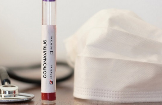 Nuk ka koronavirus në Kosovë