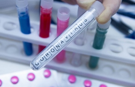Instituti i Shëndetësisë: Në Kosovë nuk ka koronavirus!