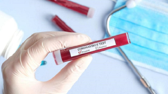 Dyshime për dy pacientë me koronavirus, por ata rezultuan negativë, Kosova e paprekur nga ky virus