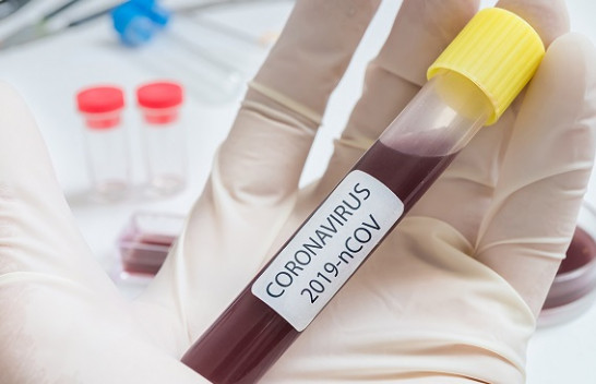 Instituti i Shëndetësisë Publike: Në Kosovë nuk ka koronavirus