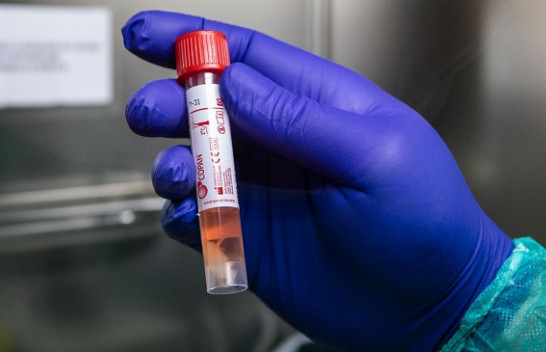 Testohen edhe dy pacientë, në Kosovë nuk s’ka koronavirus