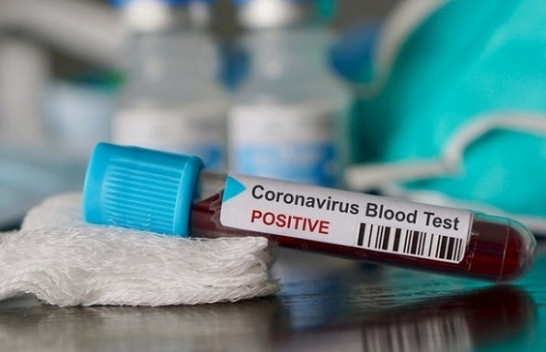 Thyhet ‘miti’ konfirmohen dy raste me koronavirus në Kosovë