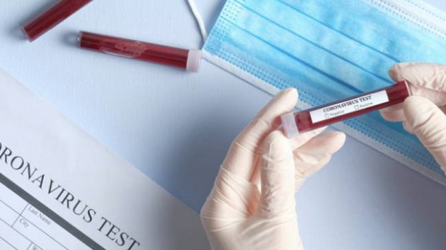 Një kosovar në Gjermani infektohet me koronavirus