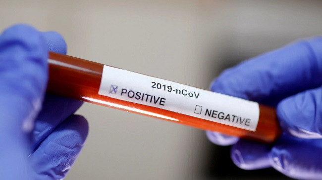 Shkon në 13 numri i të prekurve me koronavirus në Kosovë