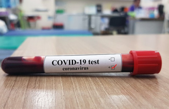 Shënohen edhe dy raste të reja me koronavirus në Kosovë, shkon në 19 numri i të infektuarve