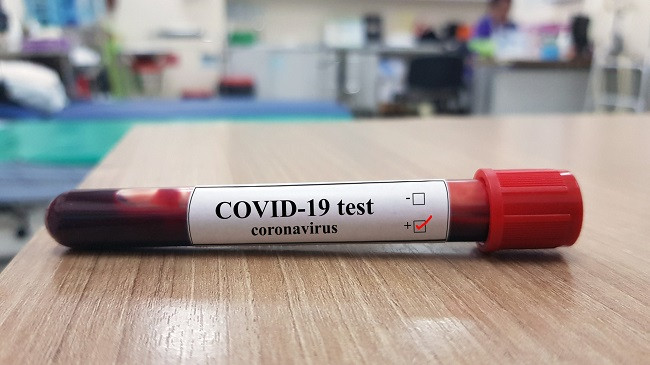 Shënohen edhe dy raste të reja me koronavirus në Kosovë, shkon në 19 numri i të infektuarve