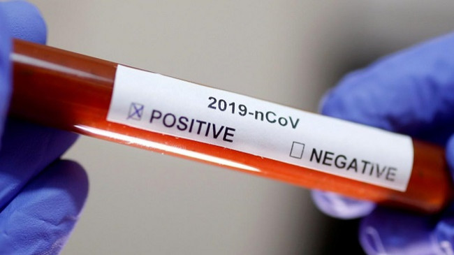 Shkon në 20 numri i të prekurve me koronavirus në Kosovë