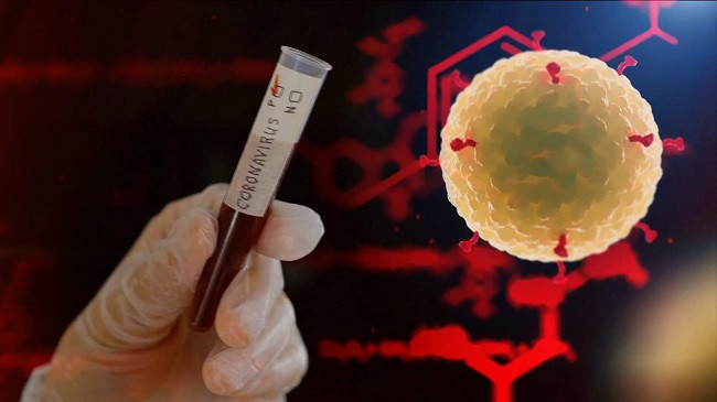 13 raste të reja me koronavirus, shkon në 89 numri i të prekurve në Shqipëri