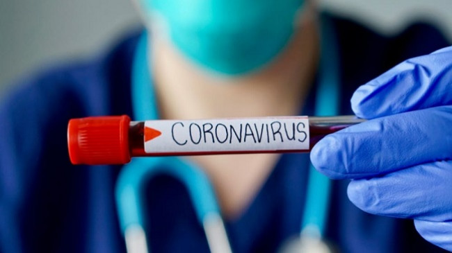 Dy raste të reja me koronavirus në Kosovë