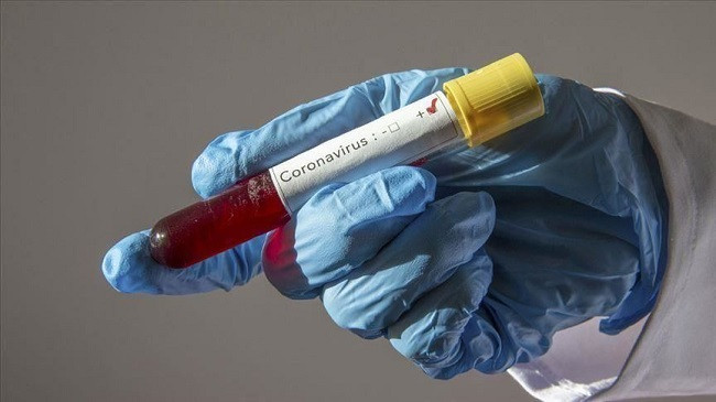 Shënohen edhe 12 raste me koronavirus, shkon në 106 numri i të prekurve në Kosovë