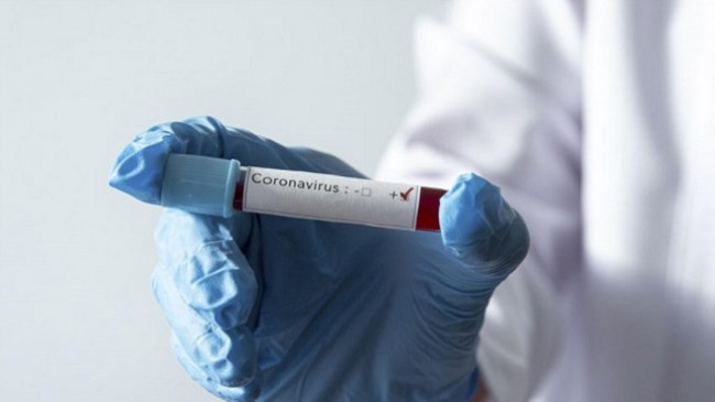 Regjistrohen edhe 13 raste të reja me koronavirus, shkon në 125 numri i të infektuarve në Kosovë