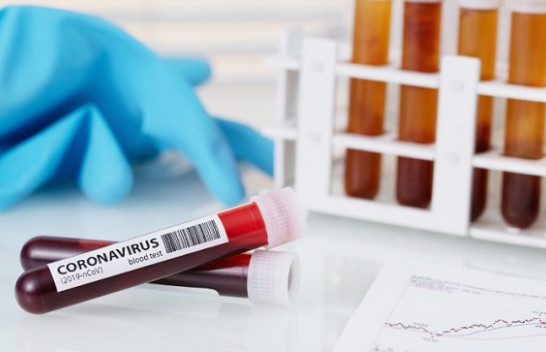 Një i shëruar dhe 32 raste të reja me koronavirus, shkon në 763 numri i të infektuarve në Kosovë