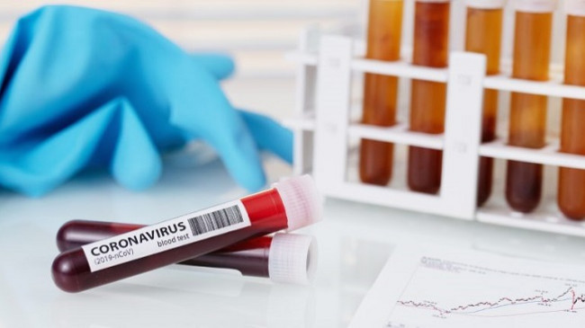 Një i shëruar dhe 32 raste të reja me koronavirus, shkon në 763 numri i të infektuarve në Kosovë
