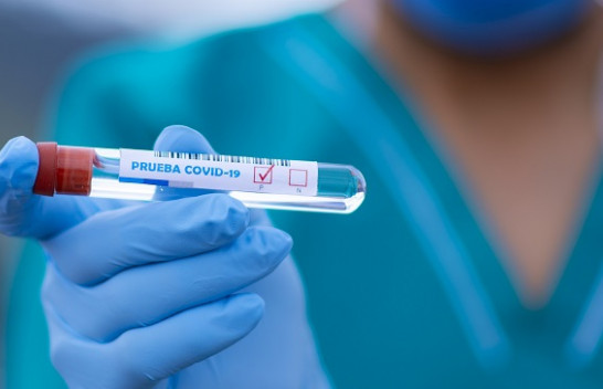 Edhe 11 raste të reja me koronavirus dhe dy të shëruar në Kosovë