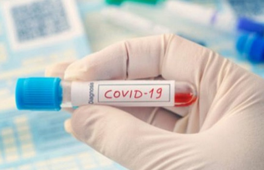 Tre të shëruar dhe 14 raste të reja me koronavirus në Kosovë