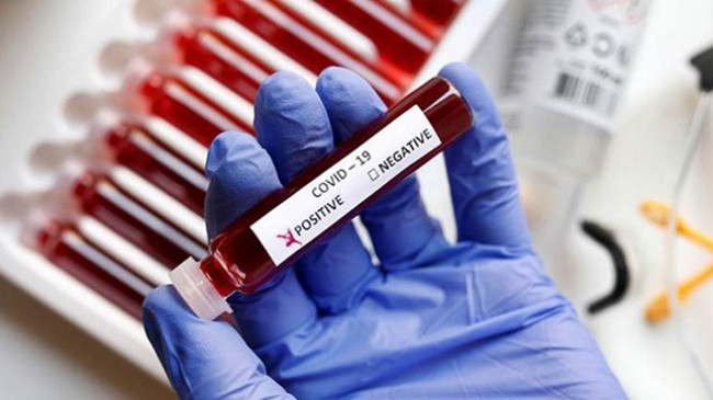 Shtatë raste të reja me koronavirus dhe tre të shëruar në Kosovë