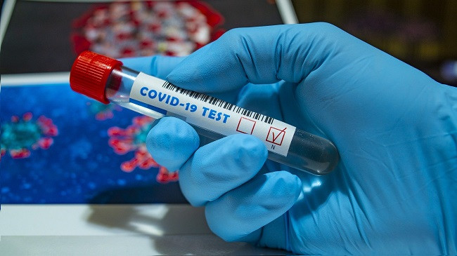 Nëntë të shëruar dhe 12 raste të reja me koronavirus në Kosovë