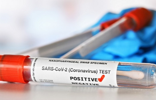 Pesë raste të reja me koronavirus dhe tre të shëruar në Kosovë