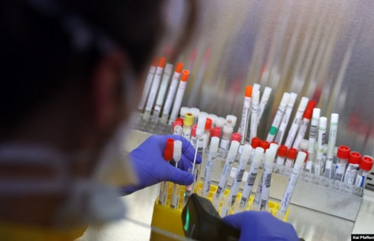 182 raste të reja me koronavirus dhe 33 të shëruar në Maqedoni