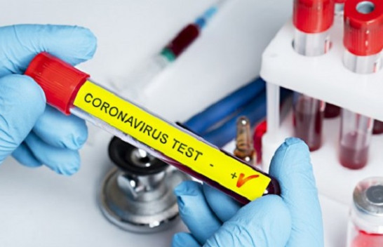Konfirmohen edhe 96 raste të reja me koronavirus dhe 29 të shëruar në Kosovë