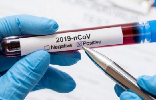 52 raste të reja me koronavirus dhe 39 të shëruar në Kosovë