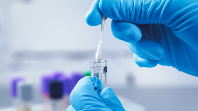 Sot 113 raste të reja me koronavirus dhe 67 të shëruar në Kosovë