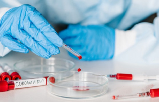 Alarmante, 276 raste të reja me koronavirus dhe 153 të shëruar në Kosovë