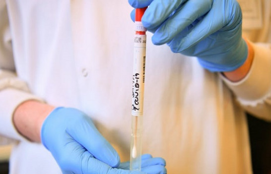 IKSHPK konfirmon 224 raste të reja me koronavirus dhe 152 të shëruar