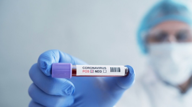 Konfirmohen 245 raste të reja me koronavirus dhe 133 të shëruar në Kosovë