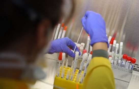 Licencohen edhe 10 laboratorë privatë për kryerjen e testeve për COVID-19
