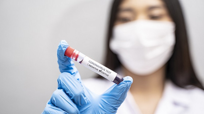 Të dhënat për 24 orët e fundit nga IKSHPK: 57 raste të reja dhe 137 të shëruar nga koronavirus në Kosovë