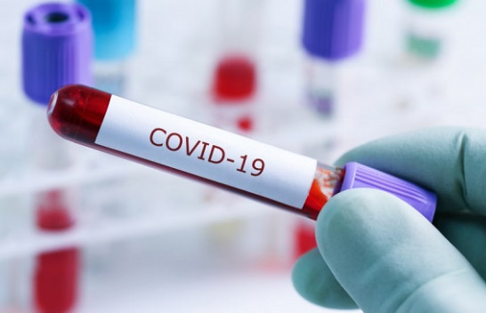 289 të infektuar në 24 orë, shifra rekord me COVID-19 në Shqipëri