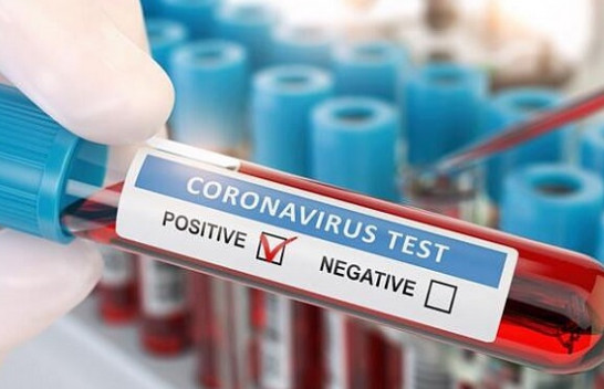 Rritet numri i të infektuarve me koronavirus në Kosovë, 148 raste të reja brenda 24 orëve