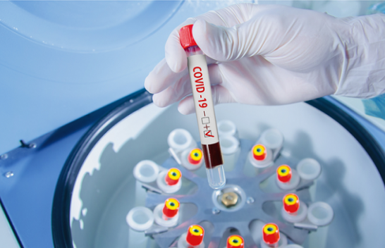 Regjistrohen 590 raste të reja dhe 696 të shëruar me koronavirus në Kosovë