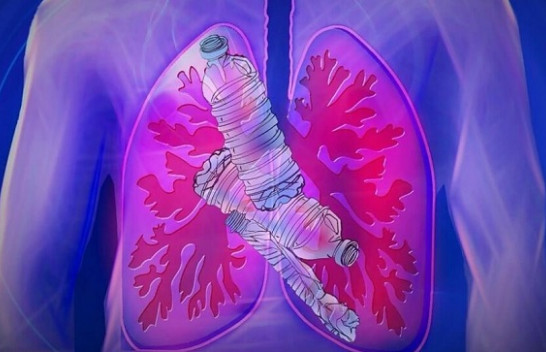Grimcat plastike zbulohen për herë të parë thellë në mushkëritë e njeriut