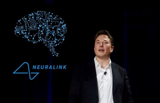 Neuralink i Elon Musk thotë se ka miratimin e FDA për studimin e implanteve të trurit tek njerëzit