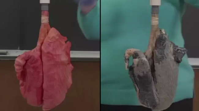 Video e tmerrshme tregon ndryshimin midis mushkërive të duhanpirësve dhe joduhanpirësve