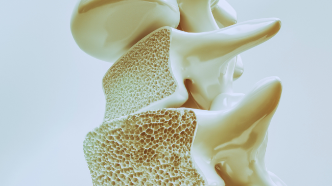 Zbulimi i madh shkencor që një ditë mund ta përmbysë osteoporozën