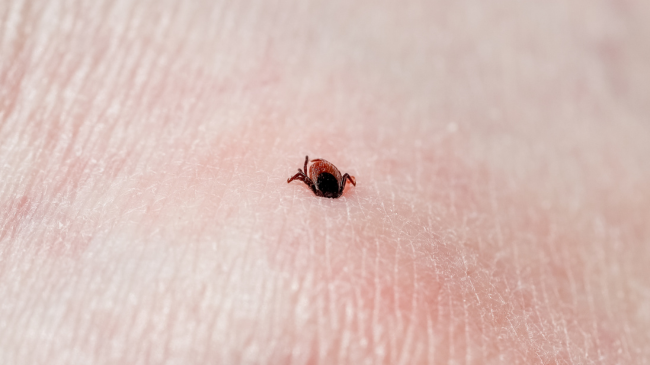 Infektologu Visar Gashi tregon çfarë ndodh kur koka e rriqrës mbetet në lëkurë